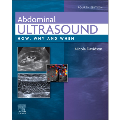 Elsevier Health Sciences Abdominal Ultrasound (inbunden, eng)