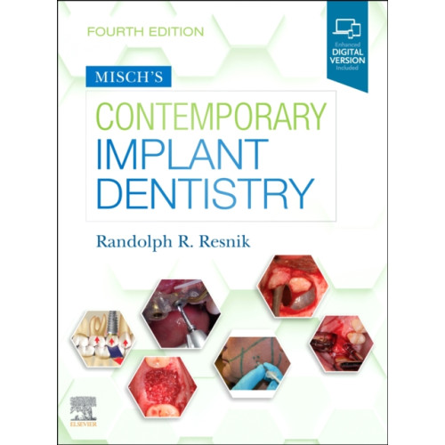 Elsevier - Health Sciences Division Misch's Contemporary Implant Dentistry (inbunden, eng)