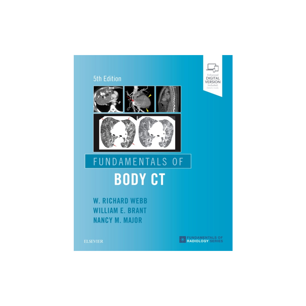 Produktbild för Fundamentals of Body CT (häftad, eng)