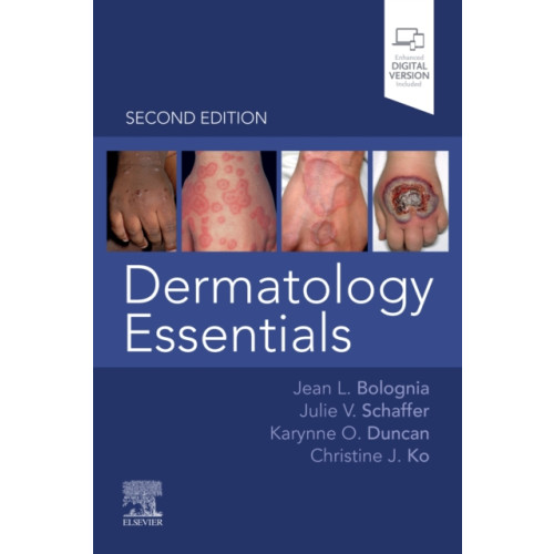 Elsevier - Health Sciences Division Dermatology Essentials (häftad, eng)