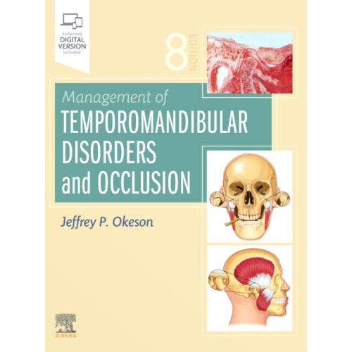 Elsevier - Health Sciences Division Management of Temporomandibular Disorders and Occlusion (inbunden, eng)