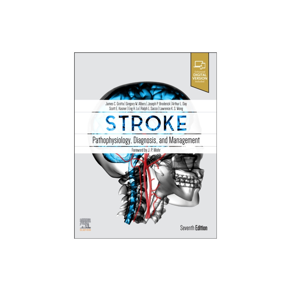 Produktbild för Stroke (inbunden, eng)