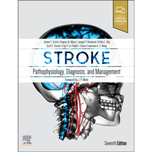 Elsevier - Health Sciences Division Stroke (inbunden, eng)