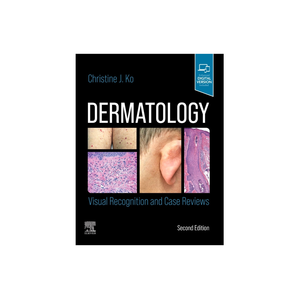 Produktbild för Dermatology: Visual Recognition and Case Reviews (häftad, eng)