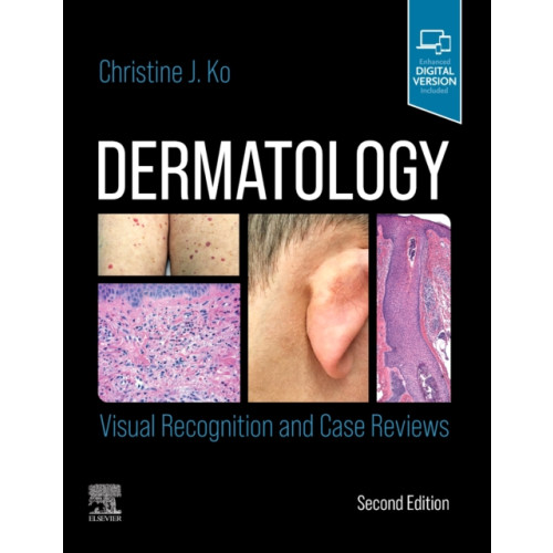 Elsevier - Health Sciences Division Dermatology: Visual Recognition and Case Reviews (häftad, eng)