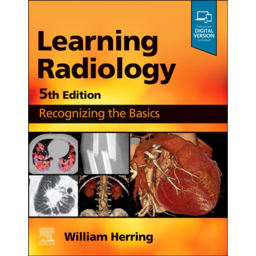 Elsevier - Health Sciences Division Learning Radiology (häftad, eng)