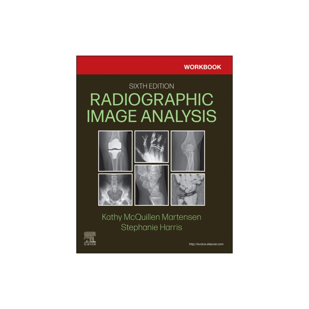 Produktbild för Workbook for Radiographic Image Analysis (häftad, eng)