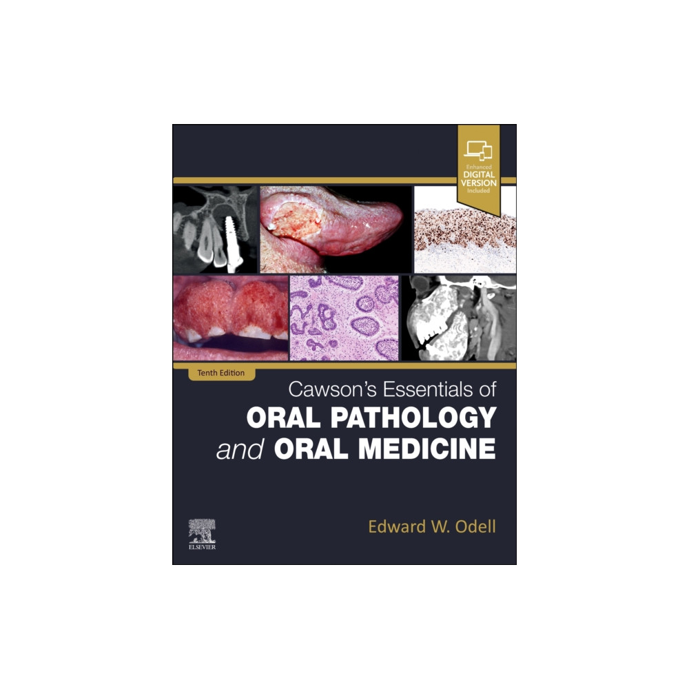 Produktbild för Cawson's Essentials of Oral Pathology and Oral Medicine (häftad, eng)