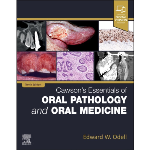 Elsevier - Health Sciences Division Cawson's Essentials of Oral Pathology and Oral Medicine (häftad, eng)