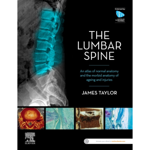 Elsevier Australia The Lumbar Spine (häftad, eng)