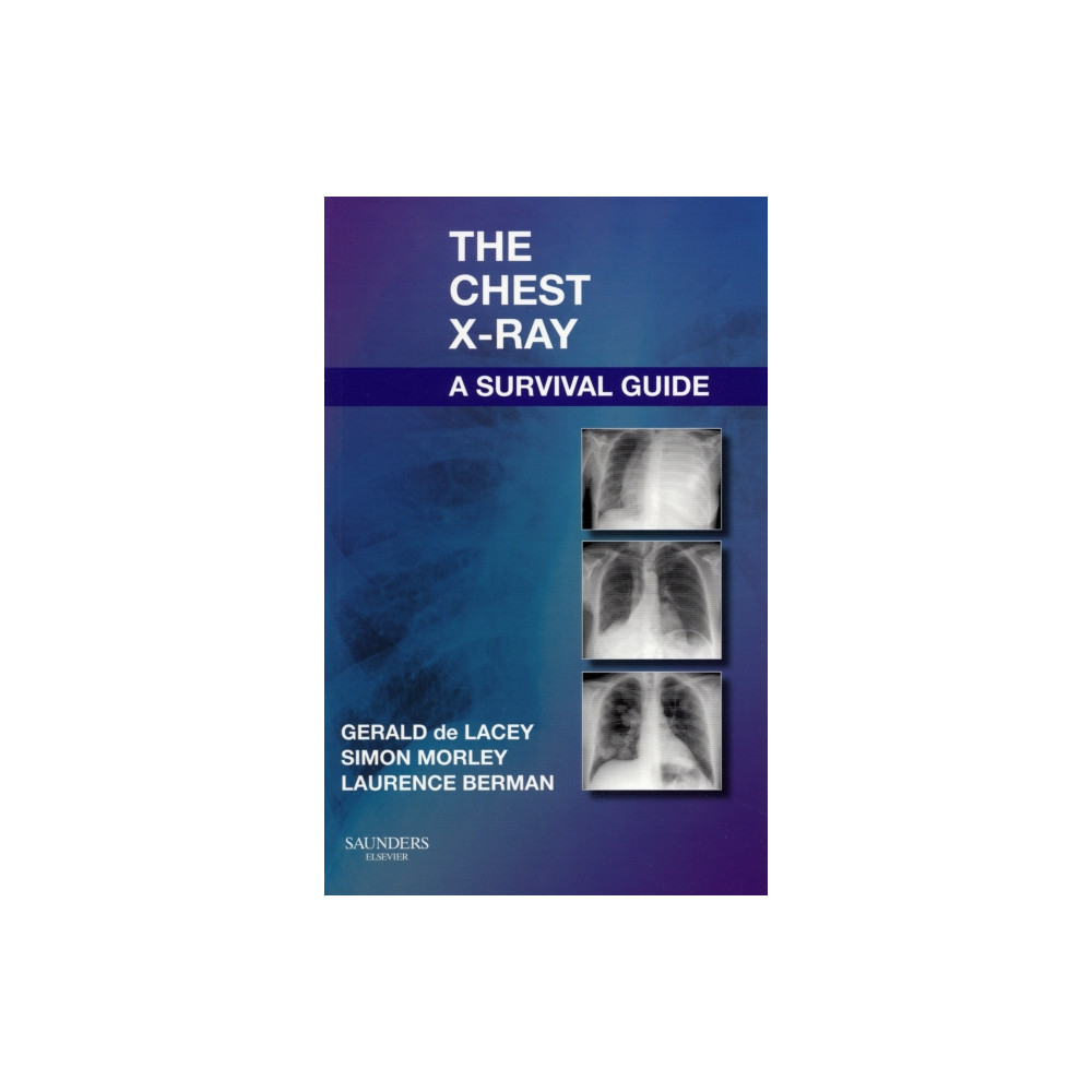 Produktbild för The Chest X-Ray: A Survival Guide (häftad, eng)