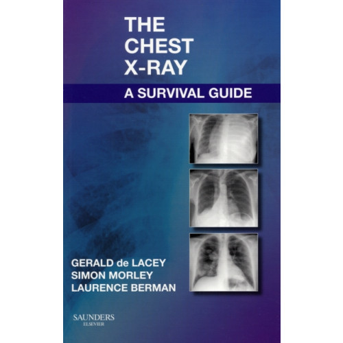 Elsevier Health Sciences The Chest X-Ray: A Survival Guide (häftad, eng)