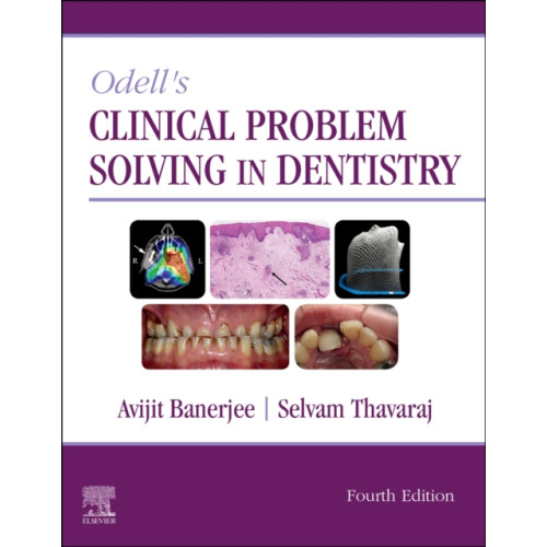 Elsevier Health Sciences Odell's Clinical Problem Solving in Dentistry (häftad, eng)