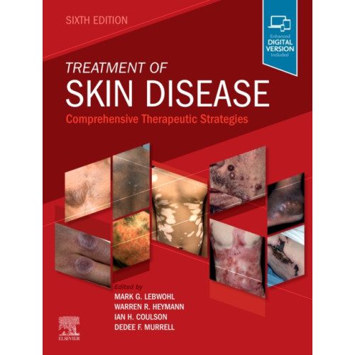 Elsevier Health Sciences Treatment of Skin Disease (inbunden, eng)