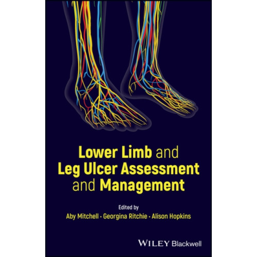 John Wiley And Sons Ltd Lower Limb and Leg Ulcer Assessment and Management (häftad, eng)