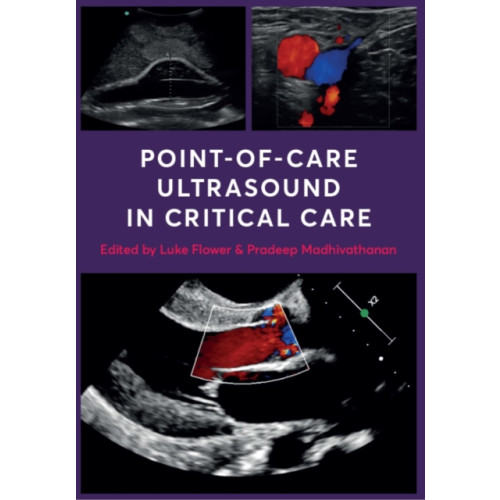 Scion Publishing Ltd Point-of-Care Ultrasound in Critical Care (häftad, eng)