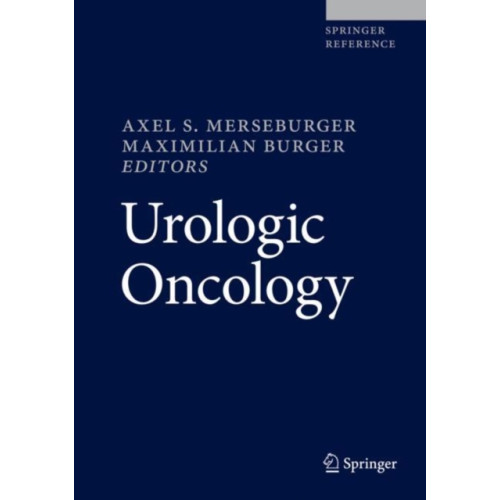 Springer International Publishing AG Urologic Oncology (inbunden, eng)