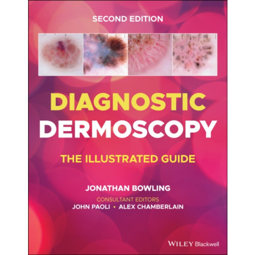 John Wiley And Sons Ltd Diagnostic Dermoscopy (häftad, eng)