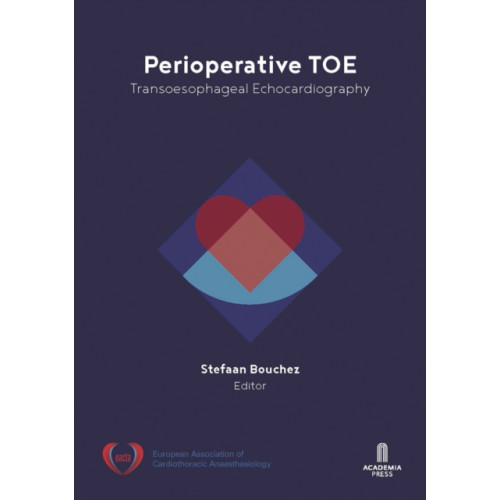 Lannoo Publishers Perioperative TOE (häftad, eng)