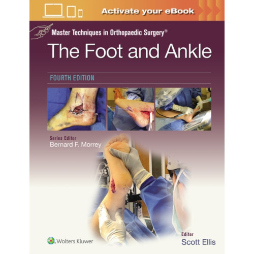 Wolters Kluwer Health Master Techniques in Orthopaedic Surgery: The Foot and Ankle: Print + eBook with Multimedia (inbunden, eng)