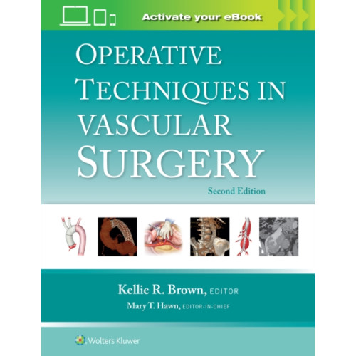 Wolters Kluwer Health Operative Techniques in Vascular Surgery: Print + eBook with Multimedia (inbunden, eng)