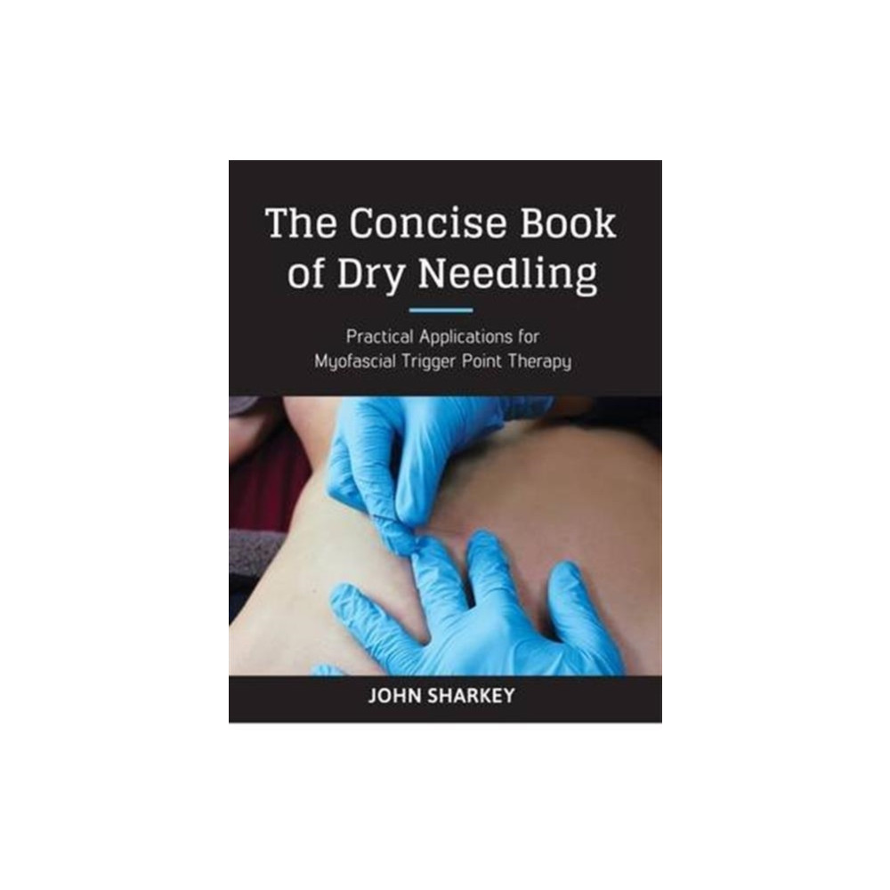 Produktbild för The Concise Book of Dry Needling (häftad, eng)