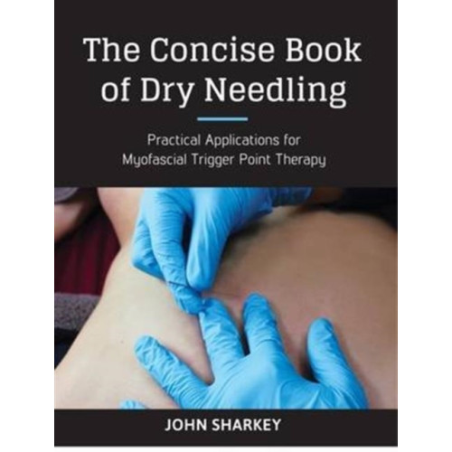 Lotus Publishing The Concise Book of Dry Needling (häftad, eng)