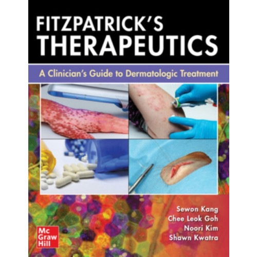 McGraw-Hill Education Fitzpatrick's Therapeutics: A Clinician's Guide to Dermatologic Treatment (häftad, eng)