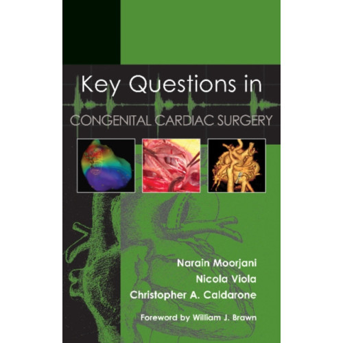 TFM Publishing Ltd Key Questions in Congenital Cardiac Surgery (häftad, eng)