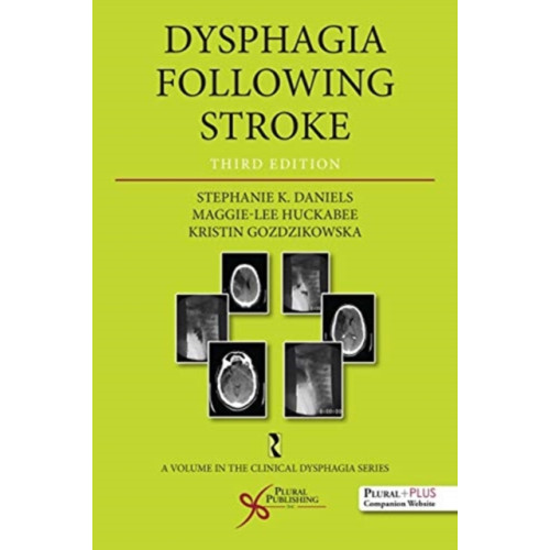 Plural Publishing Inc Dysphagia Following Stroke (häftad, eng)