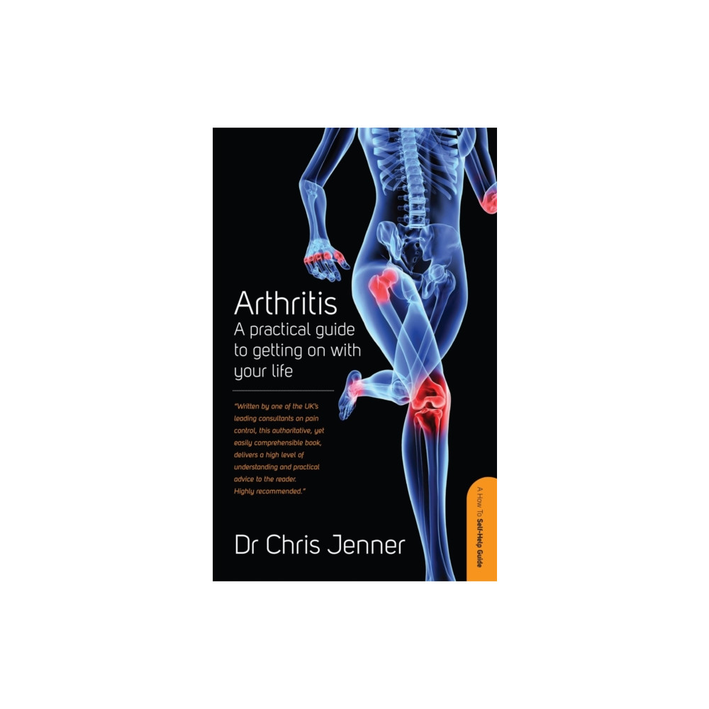 Produktbild för Arthritis (häftad, eng)
