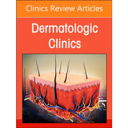 Elsevier Health Sciences Psoriasis: Contemporary and Future Therapies, An Issue of Dermatologic Clinics (inbunden, eng)