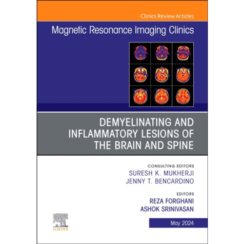 Elsevier Health Sciences Demyelinating and Inflammatory Lesions of the Brain and Spine, An Issue of Magnetic Resonance Imaging Clinics of North America (inbunden, eng)