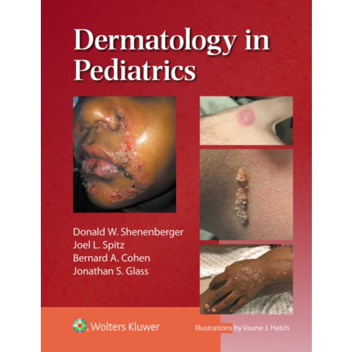 Wolters Kluwer Health Dermatology in Pediatrics (inbunden, eng)