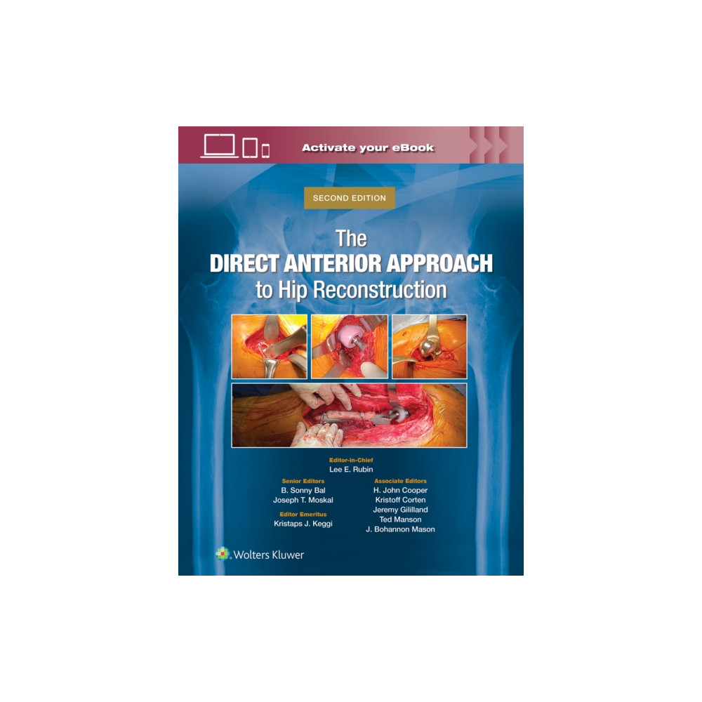 Produktbild för The Direct Anterior Approach to Hip Reconstruction (inbunden, eng)
