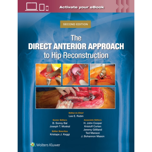 Wolters Kluwer Health The Direct Anterior Approach to Hip Reconstruction (inbunden, eng)