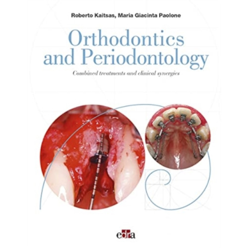 Edra Spa Orthodontics and Periodontology (inbunden, eng)