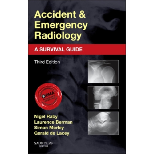 Elsevier Health Sciences Accident and Emergency Radiology: A Survival Guide (häftad, eng)