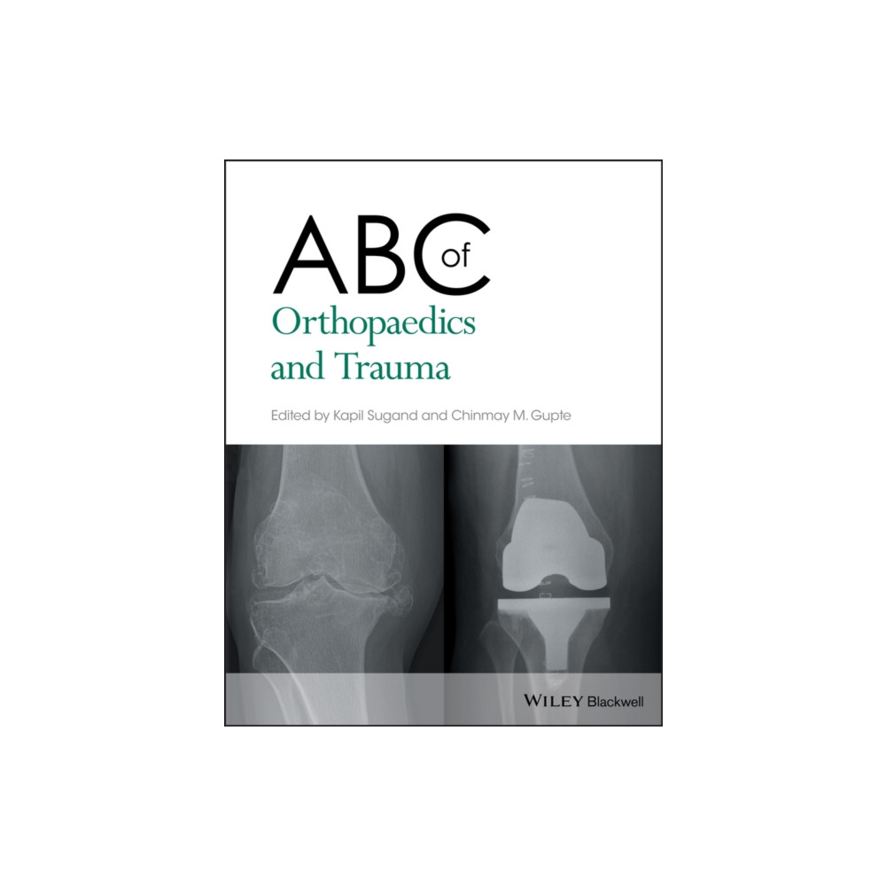 Produktbild för ABC of Orthopaedics and Trauma (häftad, eng)