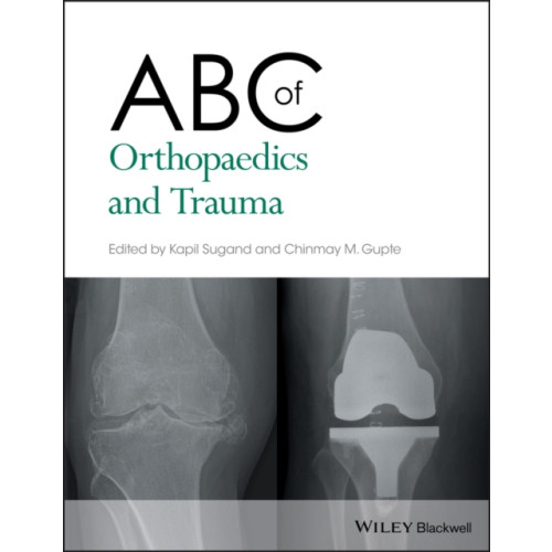 John Wiley And Sons Ltd ABC of Orthopaedics and Trauma (häftad, eng)