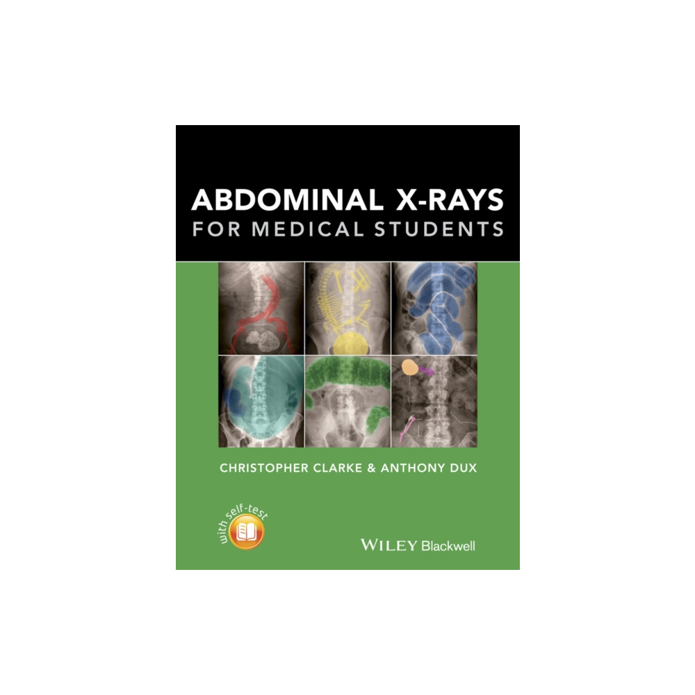 Produktbild för Abdominal X-rays for Medical Students (häftad, eng)