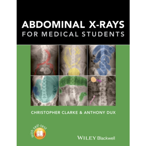 John Wiley And Sons Ltd Abdominal X-rays for Medical Students (häftad, eng)