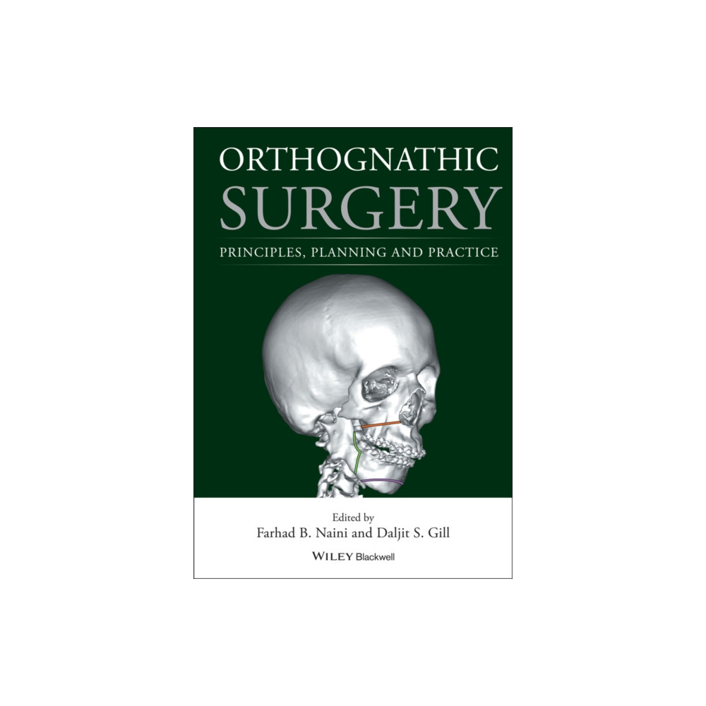 Produktbild för Orthognathic Surgery (inbunden, eng)