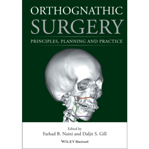 John Wiley And Sons Ltd Orthognathic Surgery (inbunden, eng)