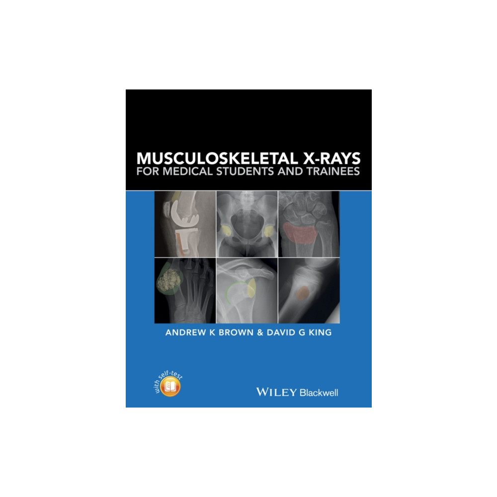 Produktbild för Musculoskeletal X-Rays for Medical Students and Trainees (häftad, eng)