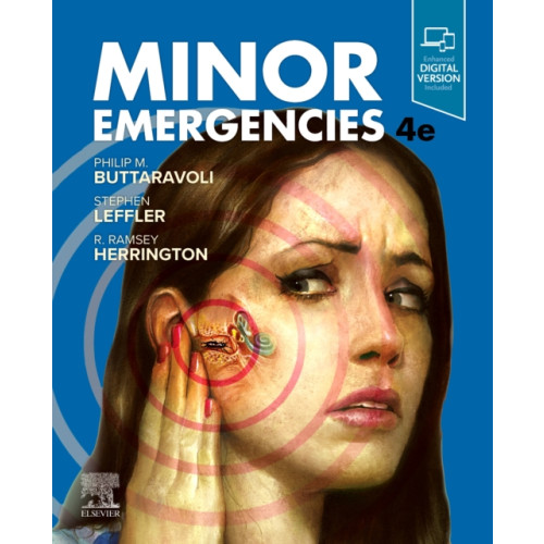 Elsevier - Health Sciences Division Minor Emergencies (häftad, eng)