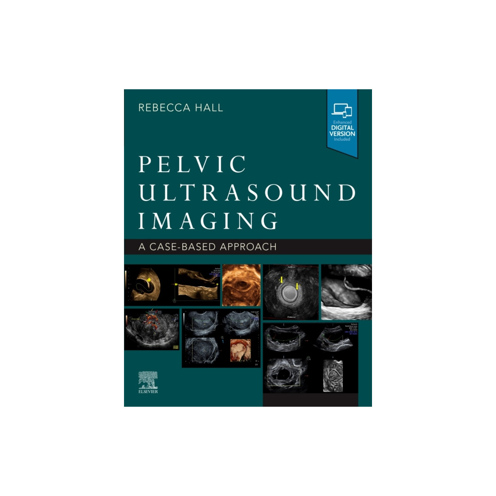 Produktbild för Pelvic Ultrasound Imaging (häftad, eng)