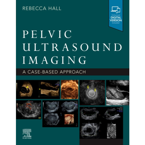 Elsevier - Health Sciences Division Pelvic Ultrasound Imaging (häftad, eng)