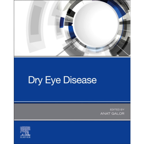 Elsevier - Health Sciences Division Dry Eye Disease (häftad, eng)