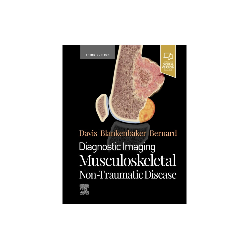 Produktbild för Diagnostic Imaging: Musculoskeletal Non-Traumatic Disease (inbunden, eng)